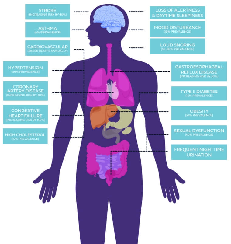 VTS Body Diagram